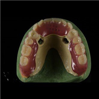 Peek Framework fogsor