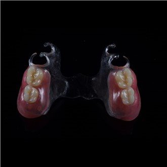 Kivehető akril részleges fogsor