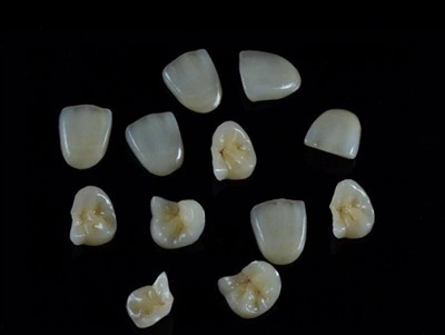 Hogyan válasszuk ki a legjobb fogászati ​​ragasztót a koronákhoz: A legújabb ...