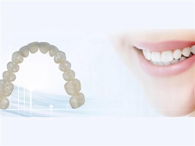 Fogászati ​​laborok kiszervezése: Előnyök, hátrányok és legfontosabb szempontok