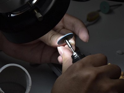 Mennyi ideig tartanak a PFM koronák? Átlagos élettartam, tényezők és gondozás...