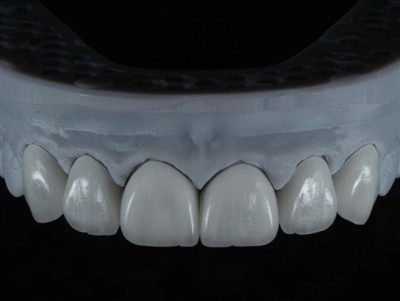 Fogászati ​​laboratóriumi technikusok külföldi munka kiszervezése: Átfogó útm...